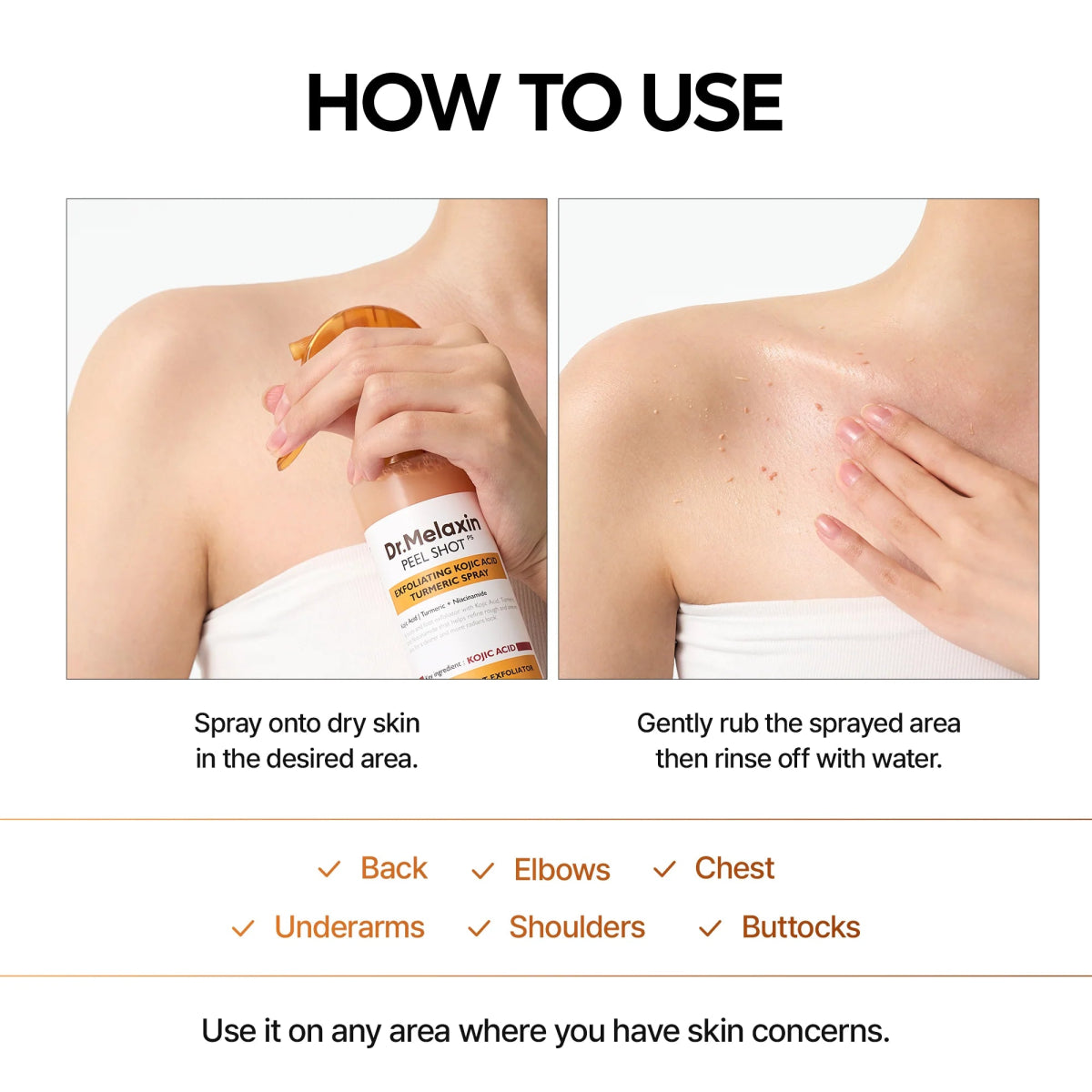 Peel Shot Kojic Acid Turmeric Spray - Pureveil