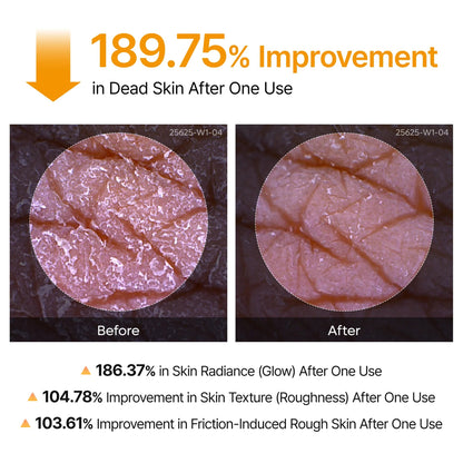 Peel Shot Kojic Acid Turmeric Spray - Pureveil